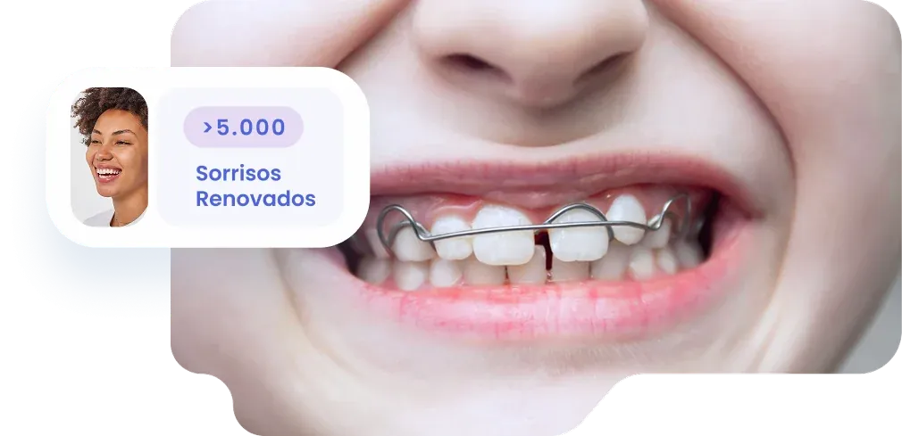 Aparelho Móvel
