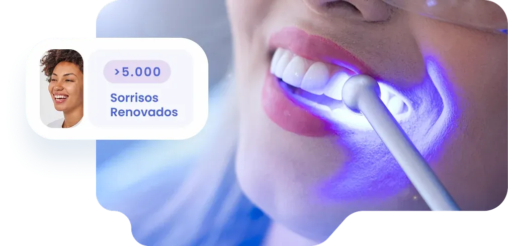 Clareamento Dental a Laser