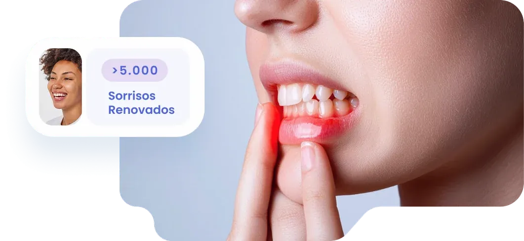 Gengivite
