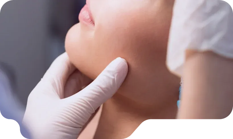 Lipo de Papada