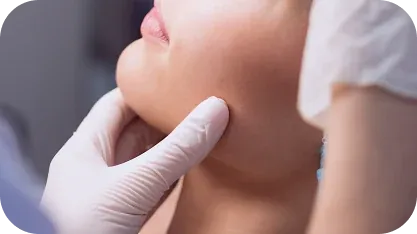 Lipo de Papada