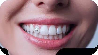 Piercing Dental